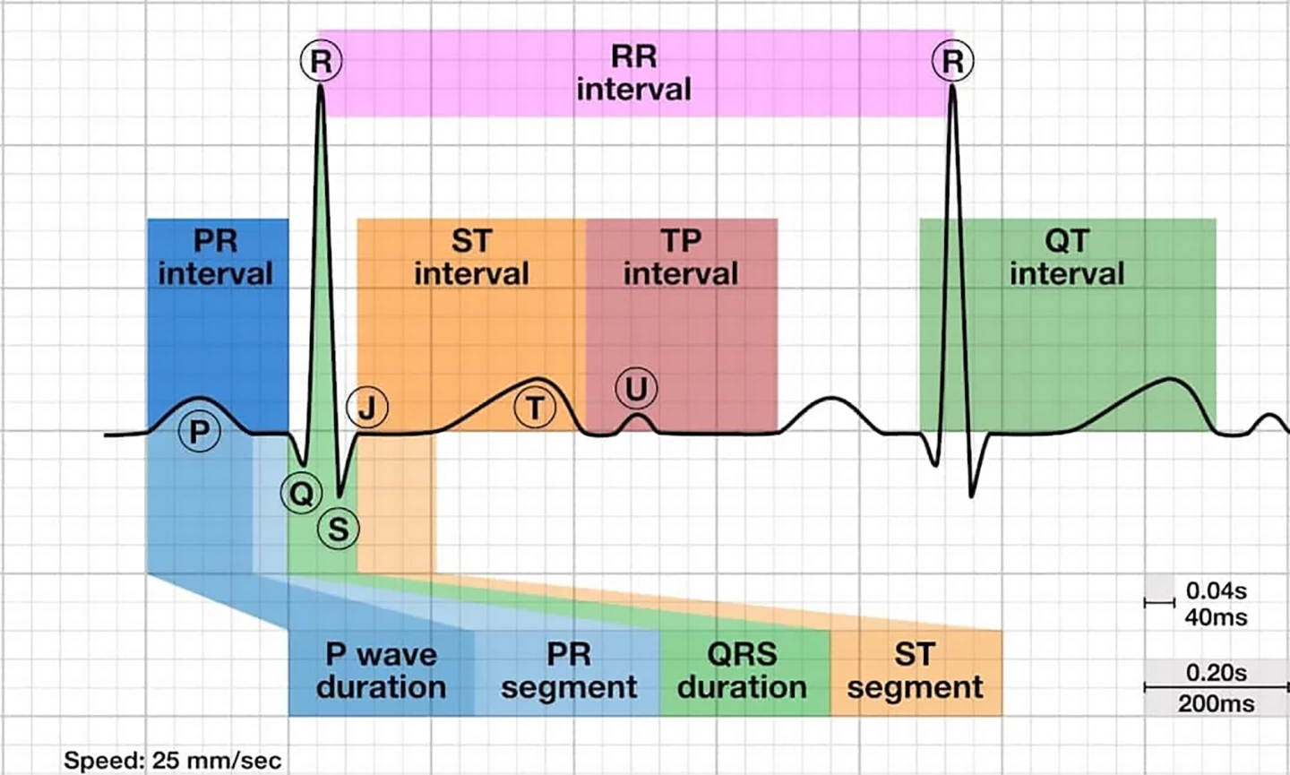 Vlna EKG, segmenty a intervaly