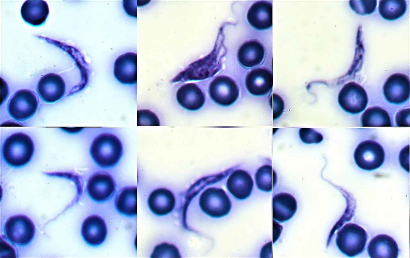 Červovitý parazit Trypanosoma cruzi mezi krevními buňkami
